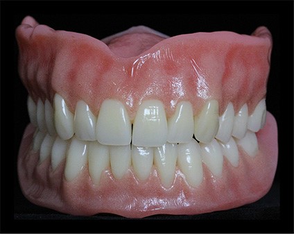 Wax Try In Dentures San Mateo CA 94404